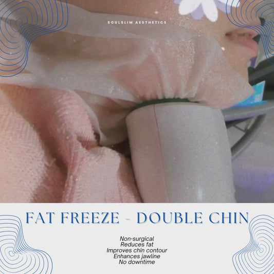 360 Cryo Fat-Freeze (Double Chin)
